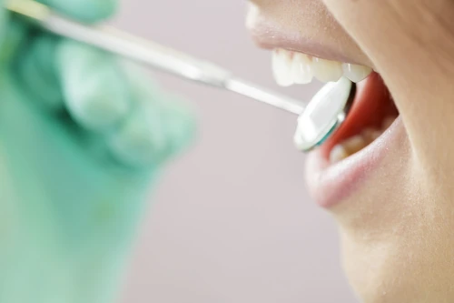 Zahnarzt untersucht Zähne mit Spiegel, professionelle Zahnkontrolle für Mundgesundheit.